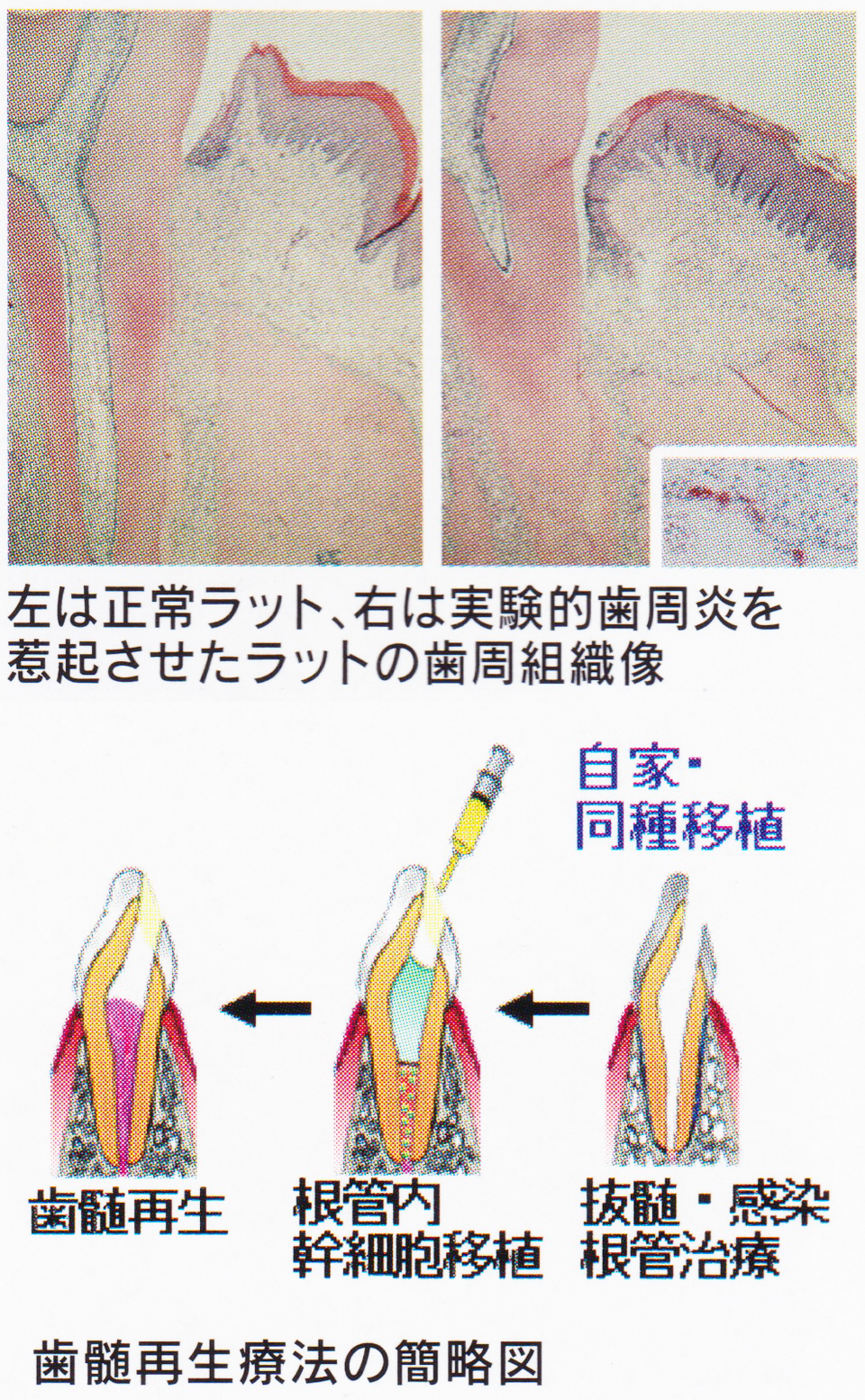 歯周歯内治療学