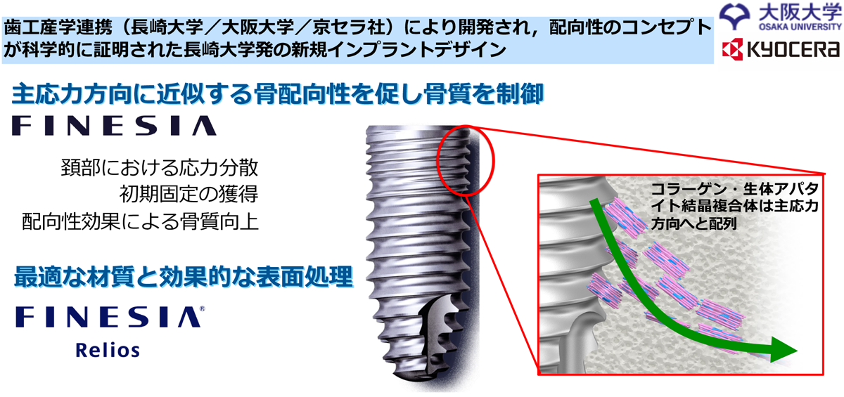 デンタルインプラントの開発