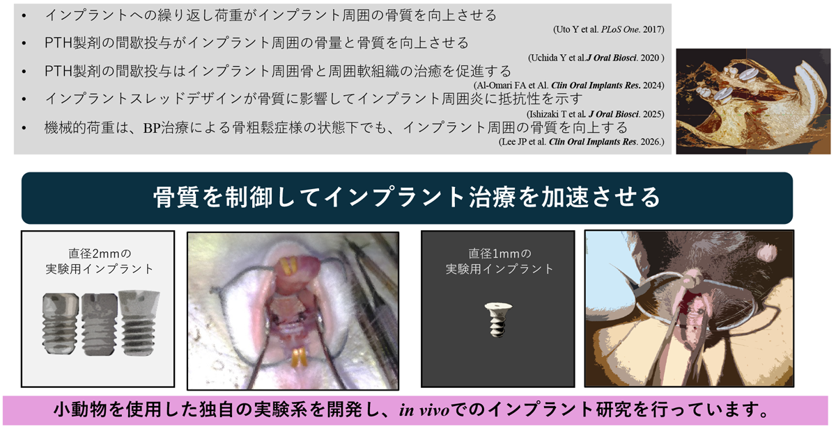 インプラント周囲の骨質解明と向上を目指した研究