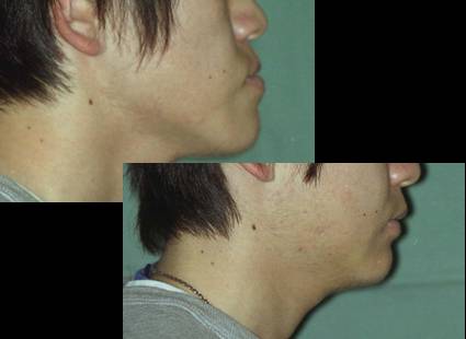 顎口腔機能再建学