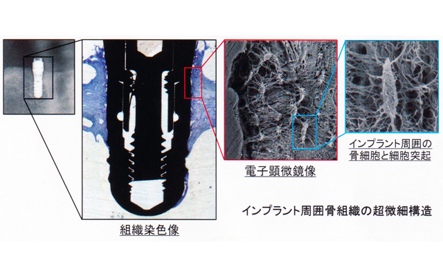 口腔インプラント学