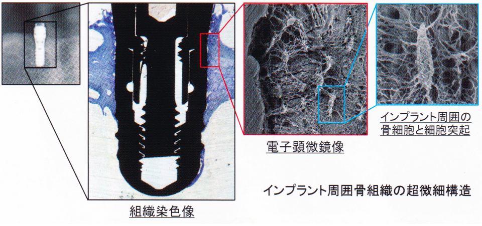 口腔インプラント学