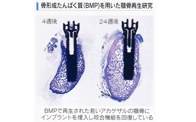 顎口腔再生外科学