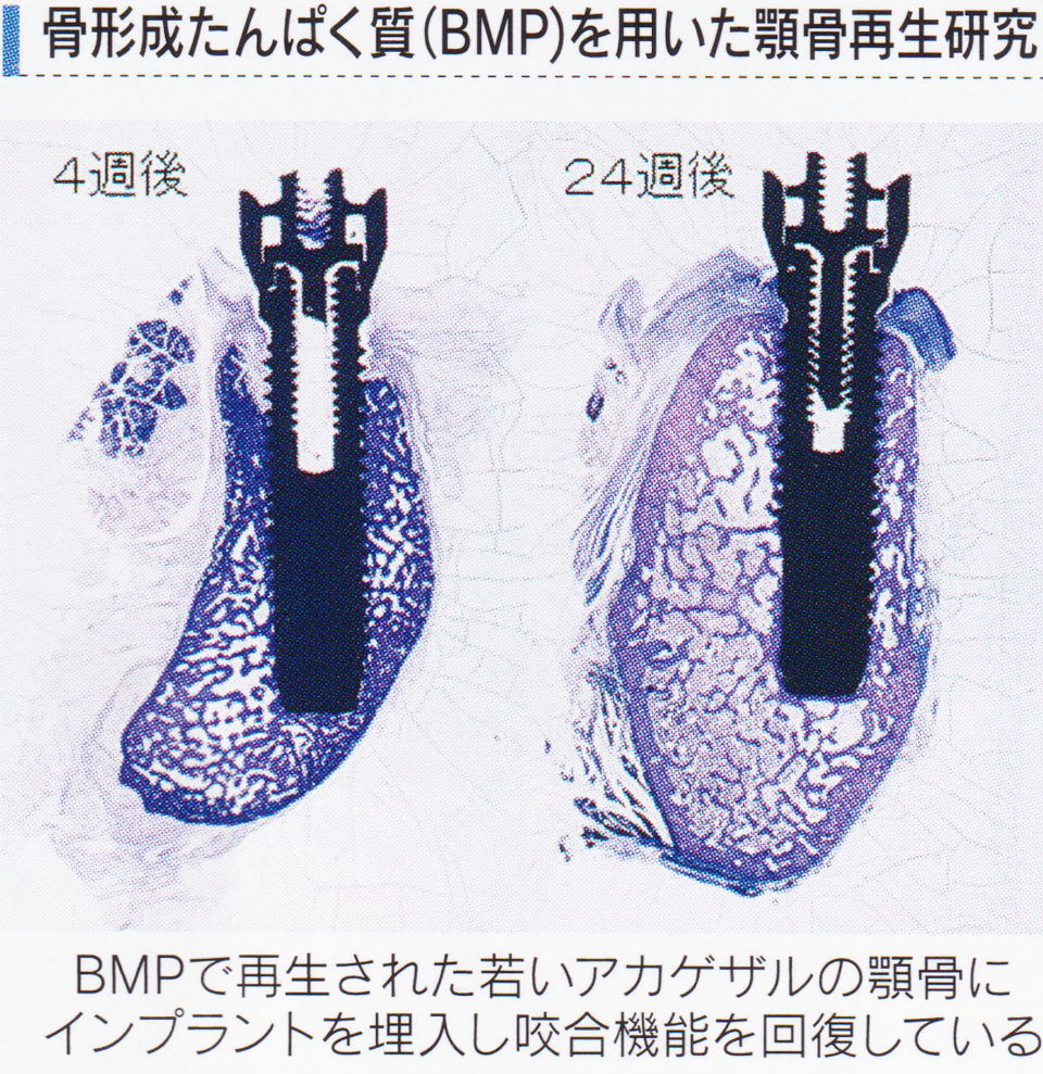 顎口腔再生外科学